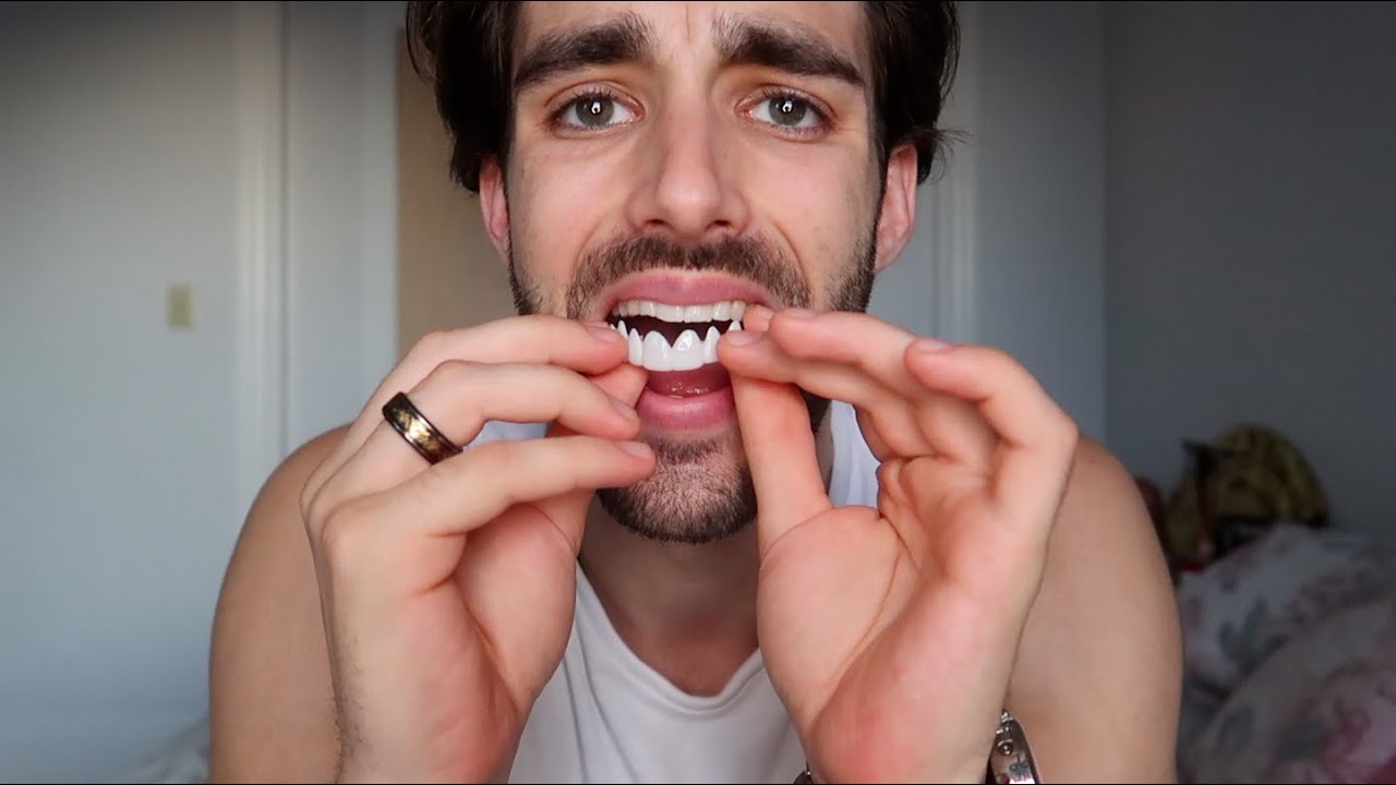 Smile Makeover With Pop On VENEERS!? *Best Quality Snap-On Smile Review* (Full Review)