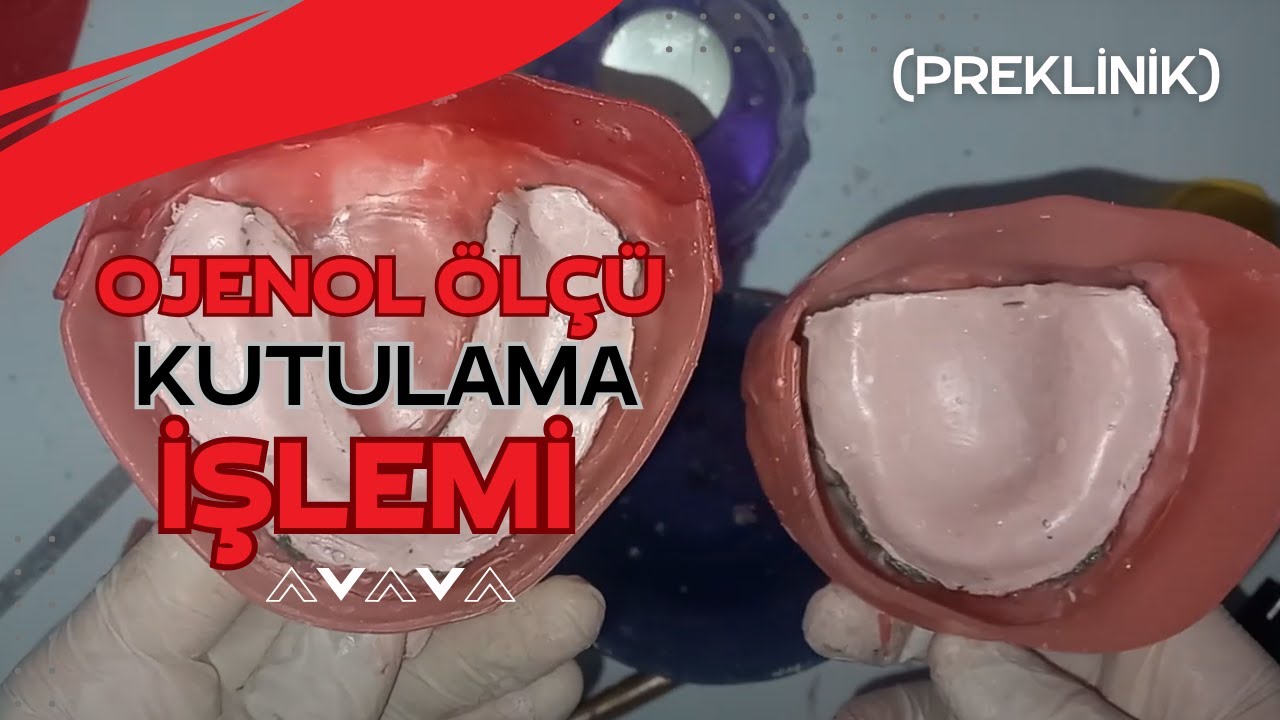 Total Protezlerde Kutulama ve Model Eldesi