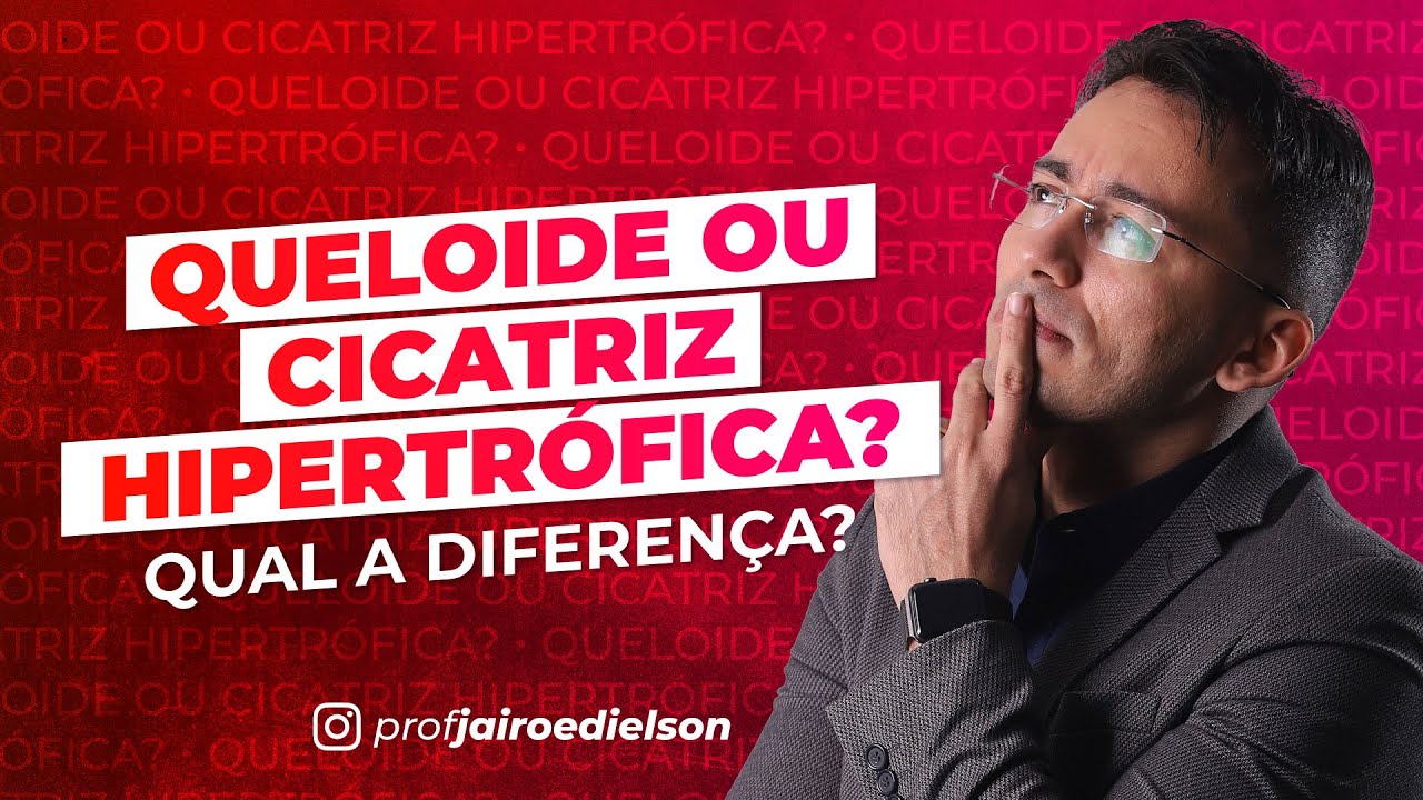 QUELOIDE OU CICATRIZ HIPERTRÓFICA? QUAL A DIFERENÇA?