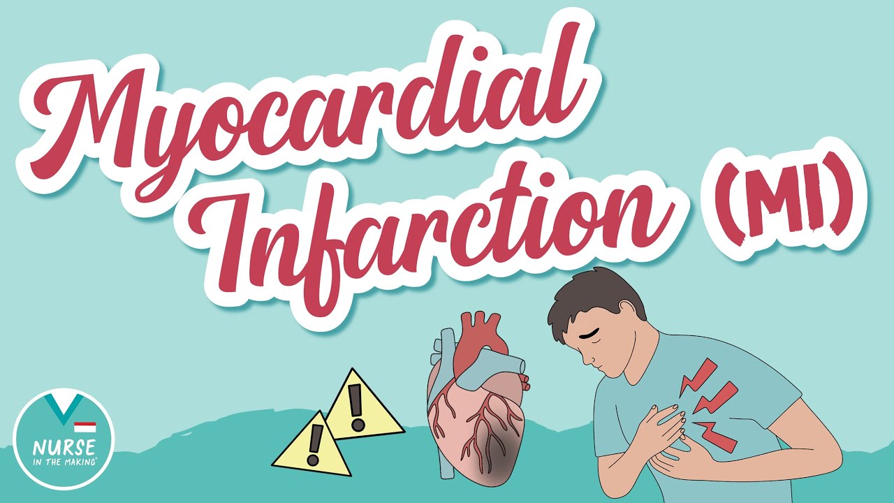 Myocardial Infarction (MI) Overview  | Med-Surg | Nursing School | Pathology | Signs & Symptoms