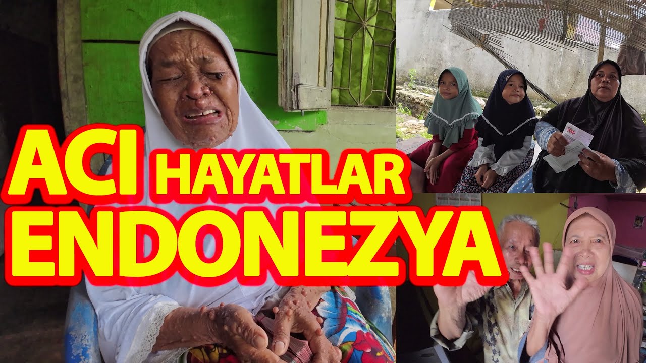 ENDONEZYA DA YOKLUK VE HASTALIK İÇİN DE YAŞAYAN İNSANLAR-DÜNYA ARTIK ONLARA DAHA GÜZEL!#endonezya
