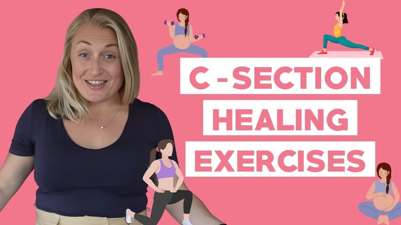 Top Workouts to Heal After C-Section