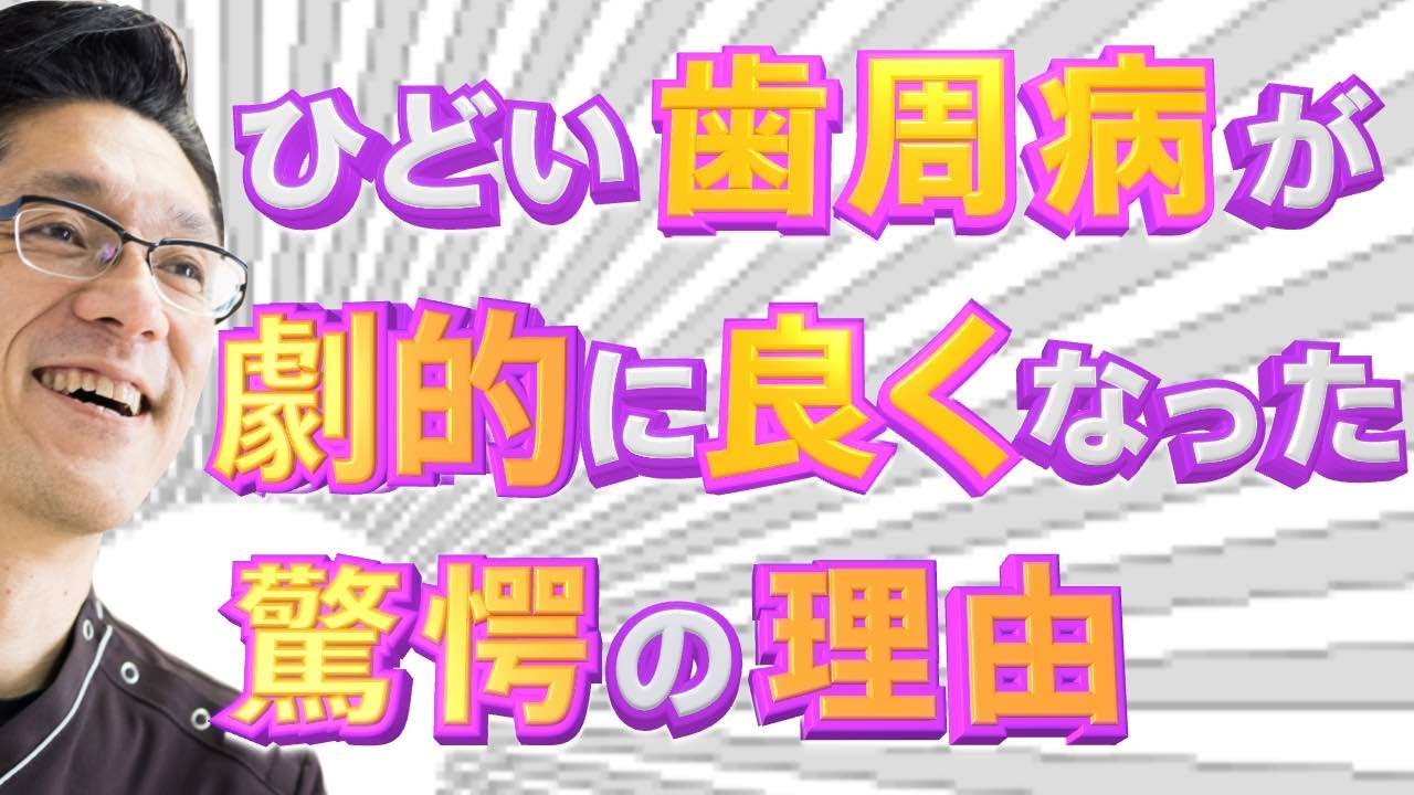 #12 なかなか良くならなかった歯周病が一撃で好転した話（上板橋　常盤台　シエル歯科クリニック　歯周病　免疫力　睡眠）