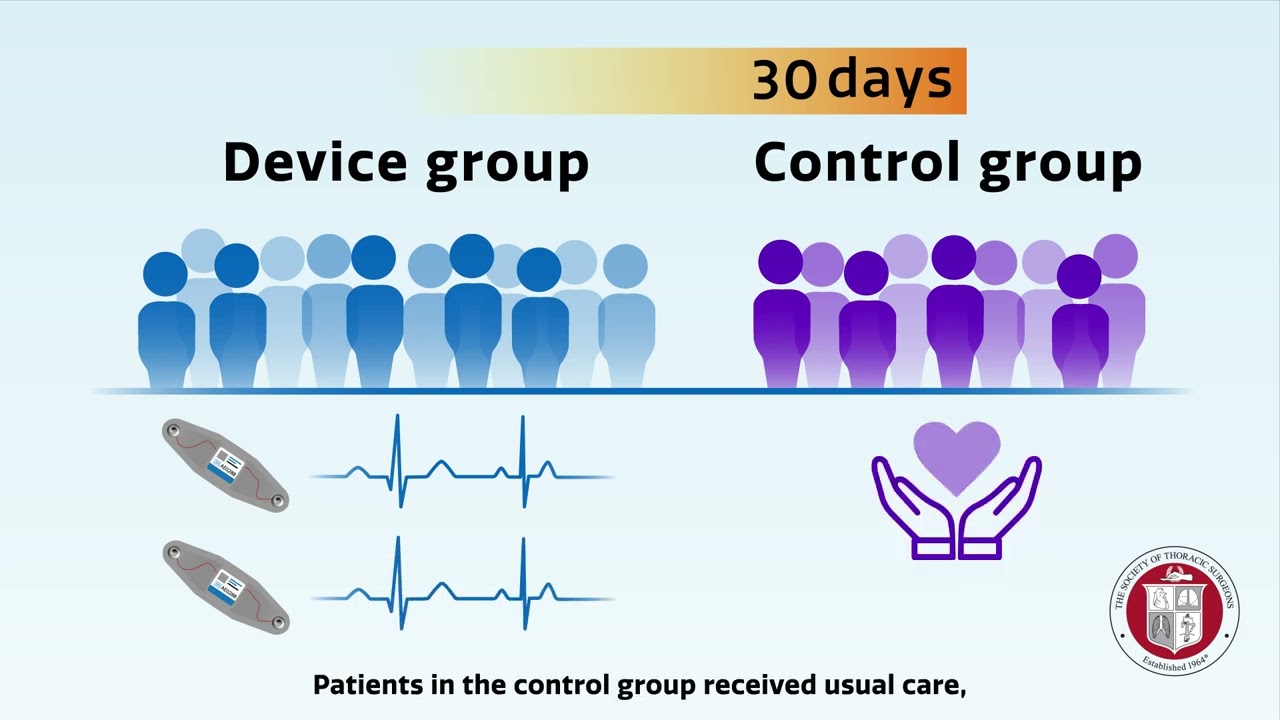 Wearable Cardiac Rhythm Monitoring Device for Detection of POAF | Annals Animated (October 2023)