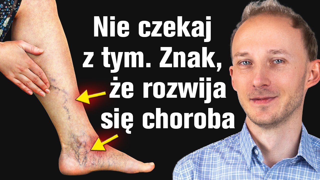 Masz to na nogach? NIE CZEKAJ, reaguj najlepiej od razu