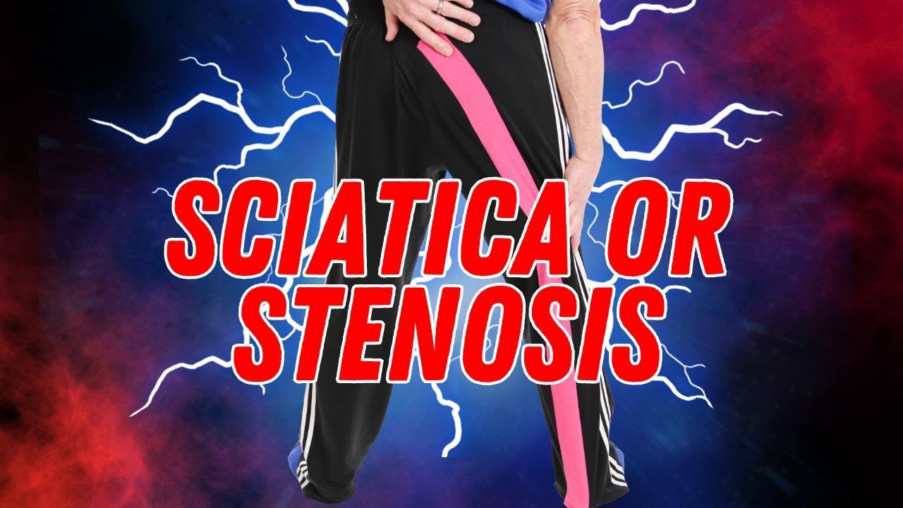 Is your Leg Pain Sciatica or Stenosis? How to Tell & How to Treat