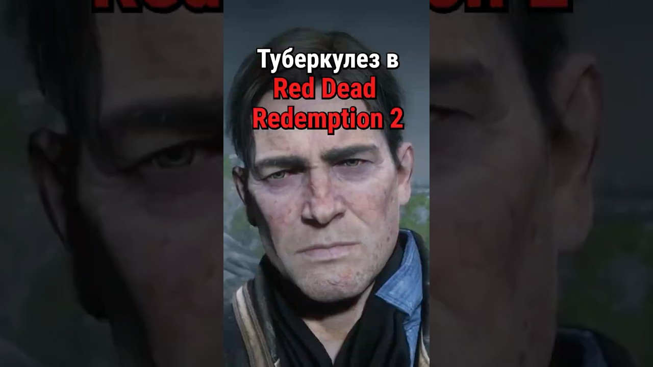 Туберкулез в RDR 2