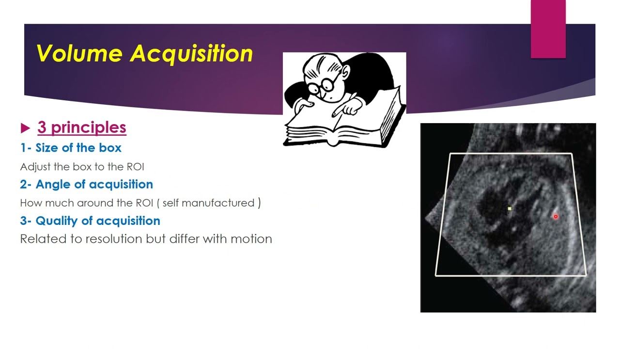 3D in obstetrics& gynecology ,basics of volume sonography
