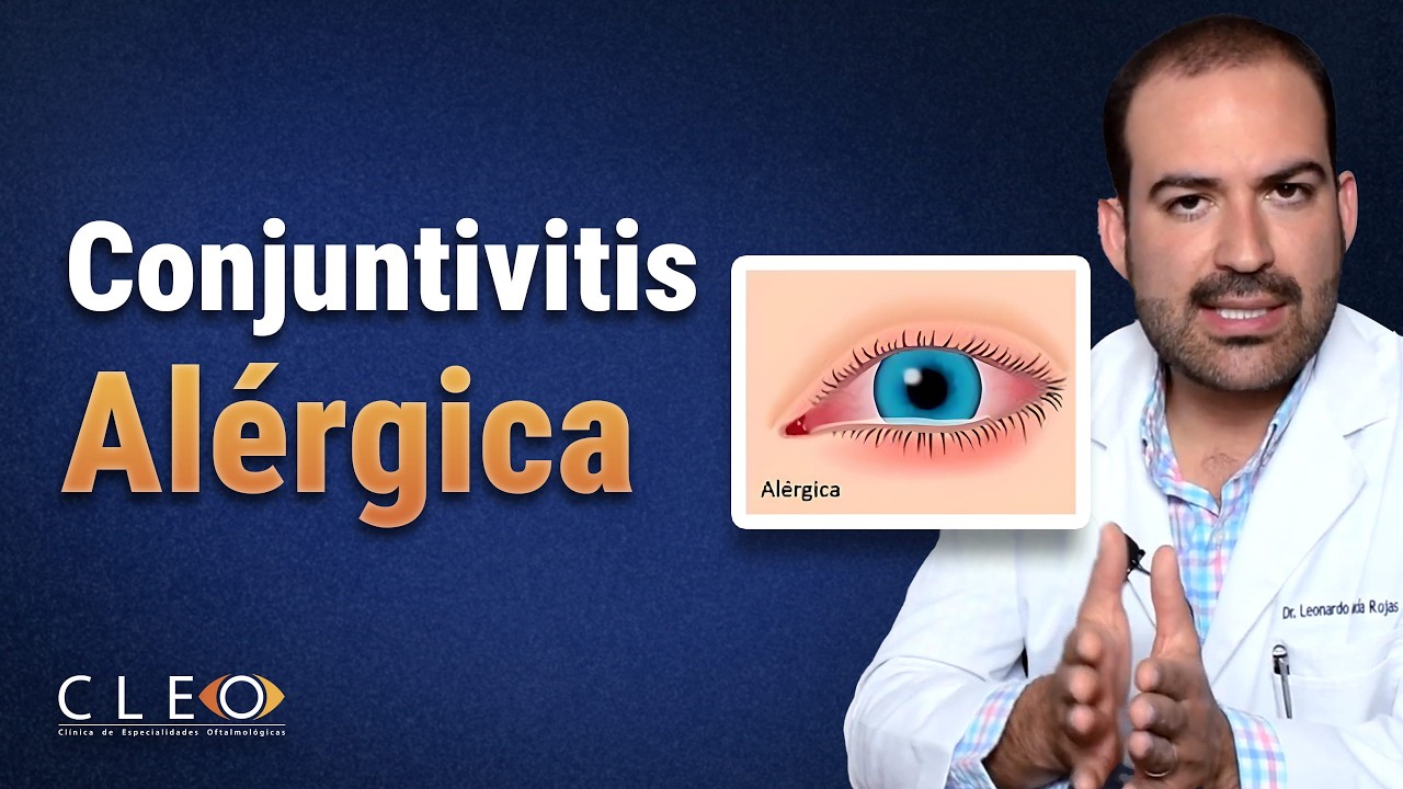 👀 Conjuntivitis Al&eacute;rgica: S&iacute;ntomas, Causas y Tratamientos Efectivos | Gu&iacute;a Completa
