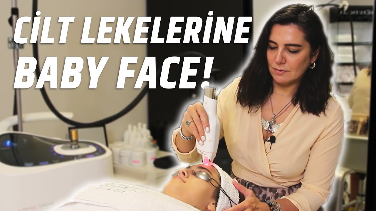 Baby Face Beauty ile Cilt Lekelerine Çözüm