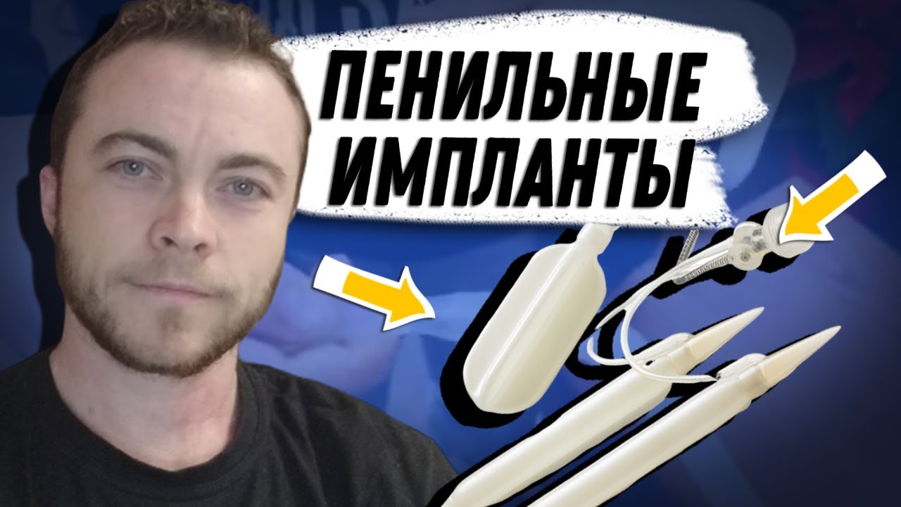 🐛 Пенильные импланты (для ФТМ)