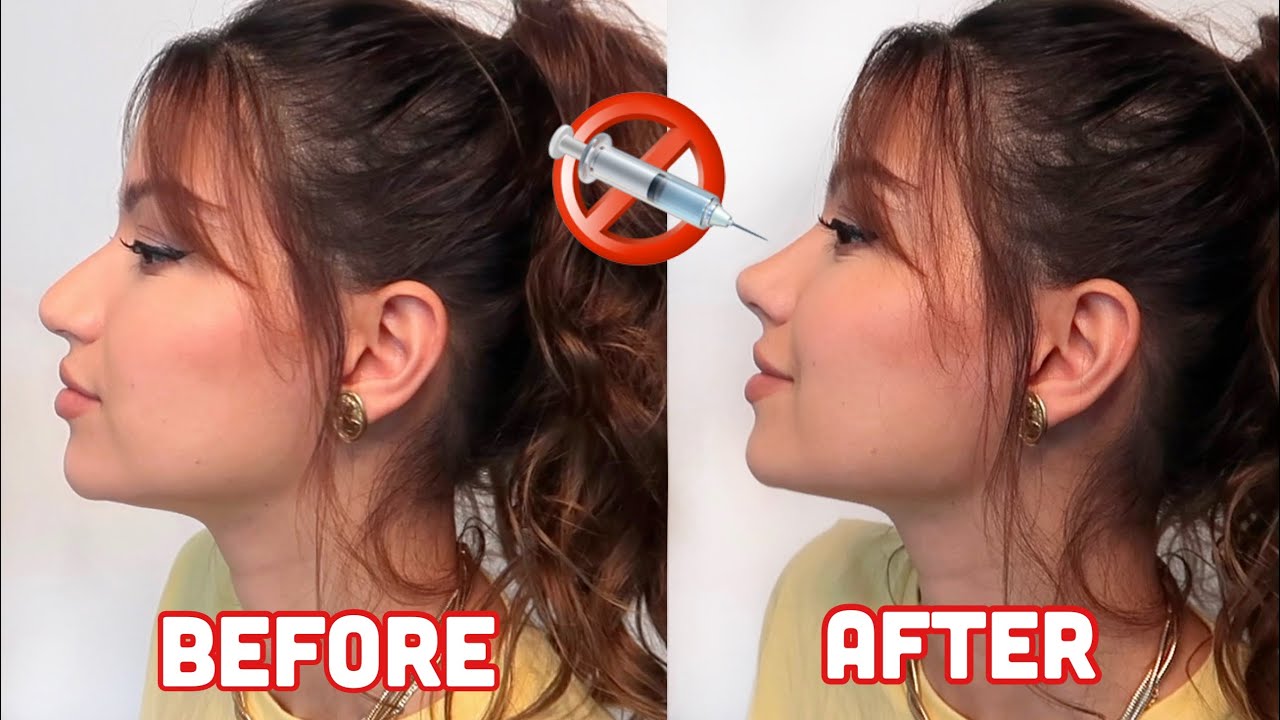 AT HOME RHINOPLASTY IN MINUTES! No surgery! No filler!
