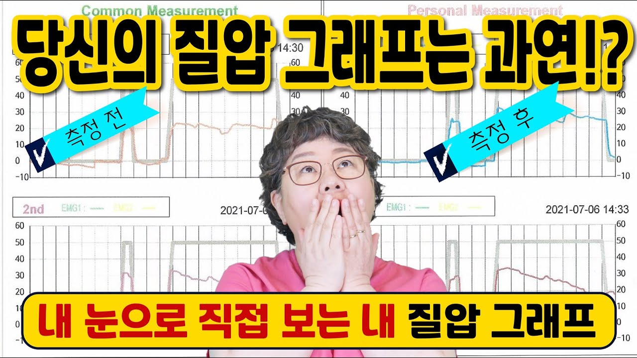 [산부인과TV 315편] 질압측정사례로 알아보는 질압의 힘