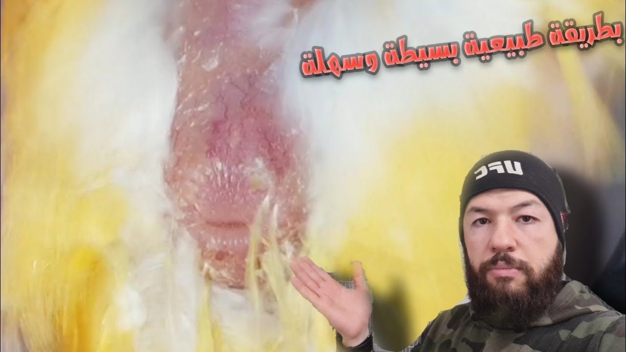 وداع لدهون البطن (التشحيم ) خلال أسبوع بطرق طبيعية #birds #كناري 
