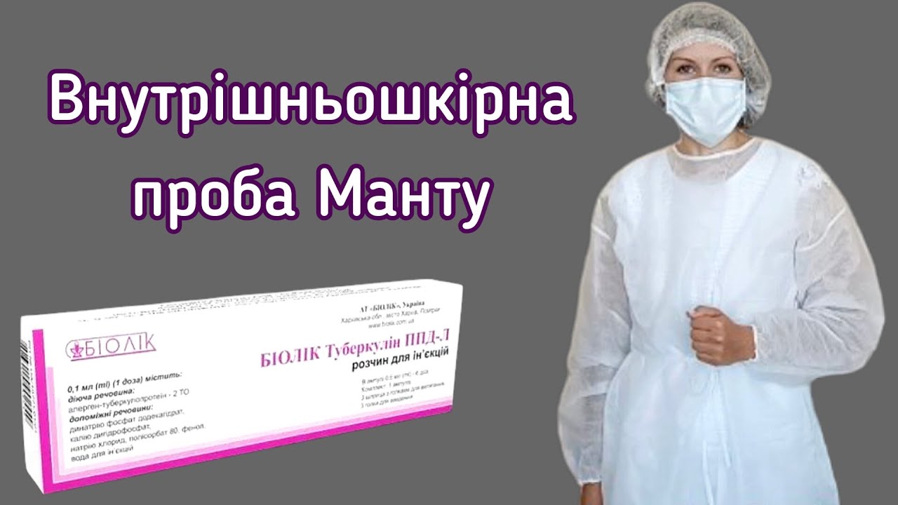 Внутрішньошкірна проба Манту