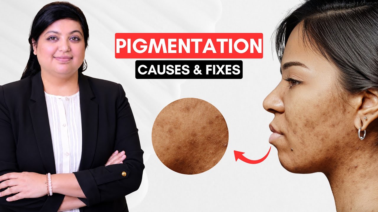 Facial Pigmentation Explained | Causes, Treatments, Melasma & Dark Spot Removal