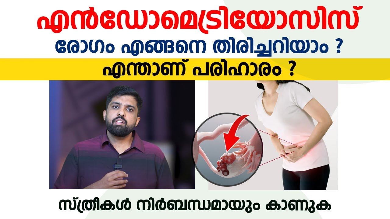 എൻഡോമെട്രിയോസിസ് രോഗം എങ്ങനെ തിരിച്ചറിയാം ? എന്താണ് പരിഹാരം | Endometriosis Malayalam
