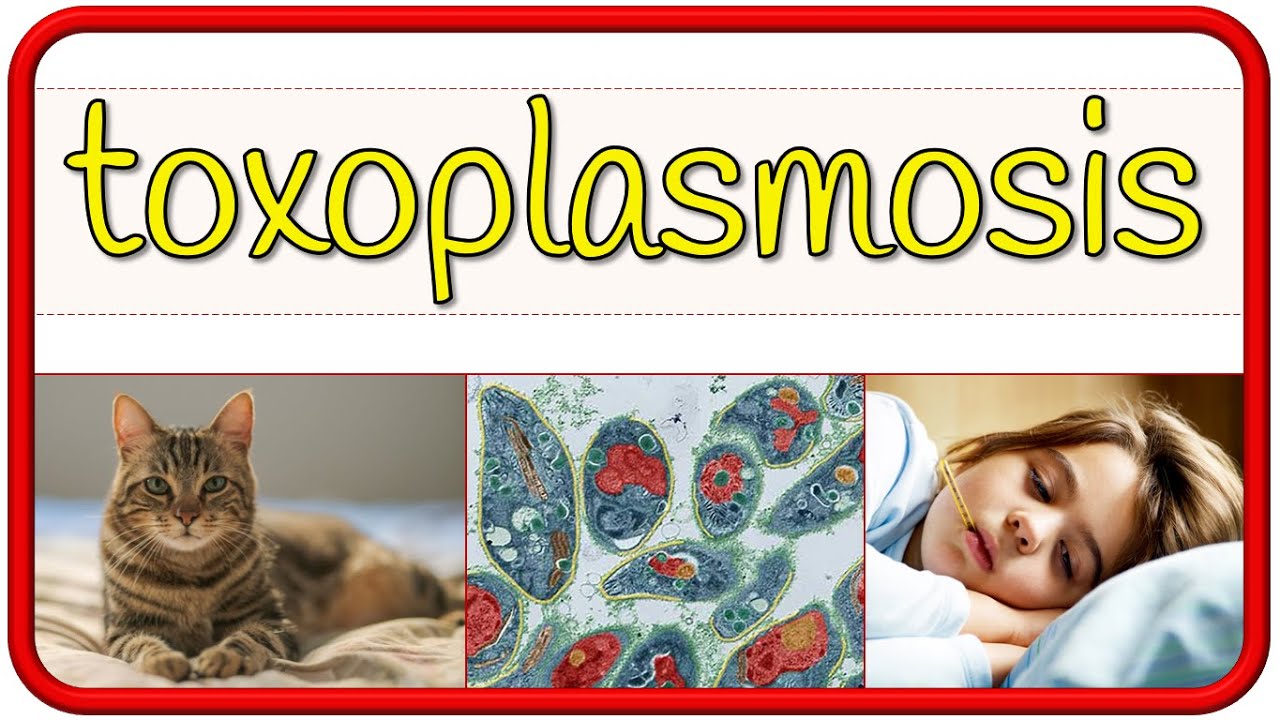 TOXOPLASMOSIS - fisiopatología, signos y síntomas, diagnóstico, tratamiento y prevención