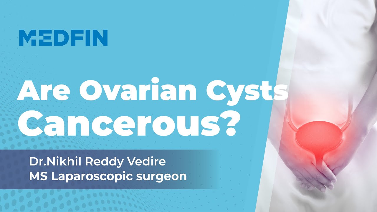 How can I Treat Ovarian Cysts?
