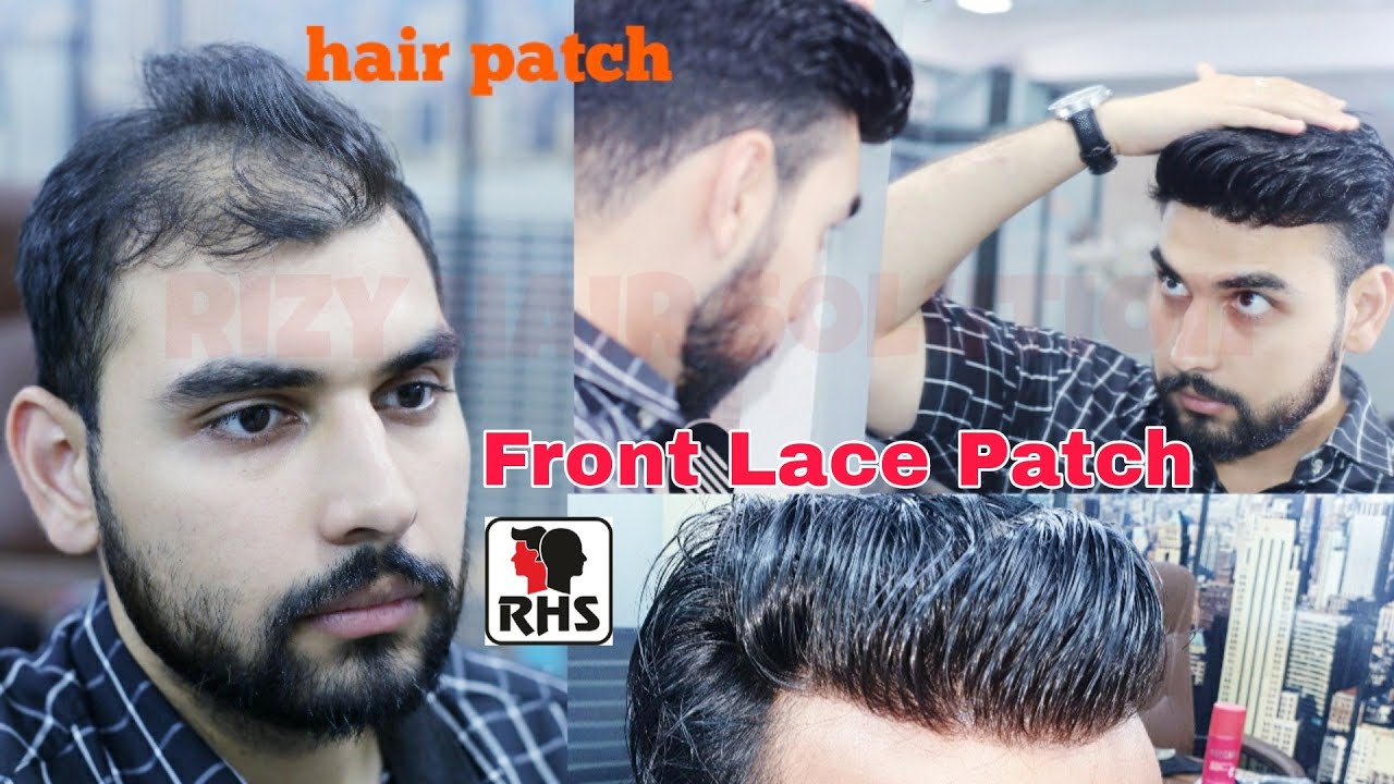 Front lace Hair Patch | Natural Hairline | Q6 Hair Patch | Important Hair Patch | 9599858612