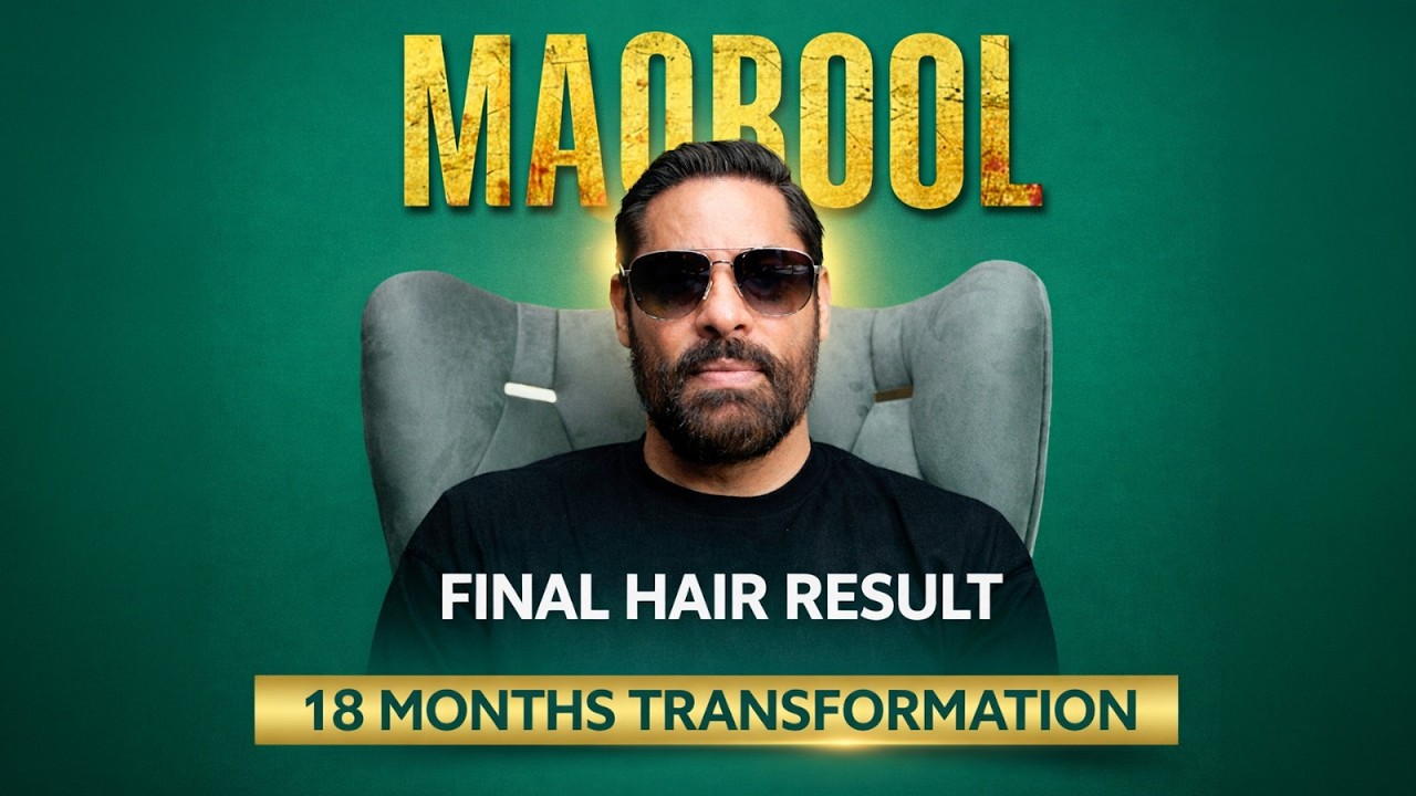 Natural & Dense Look Shaji Choudhary Shares His Hair Transplant Experience #hairtransplantphotos