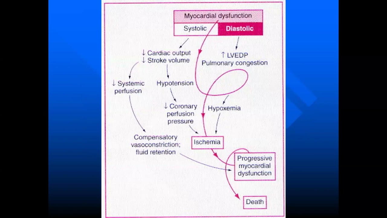 Dr Adel Gamal, 9 Nov 2023 complication of MI