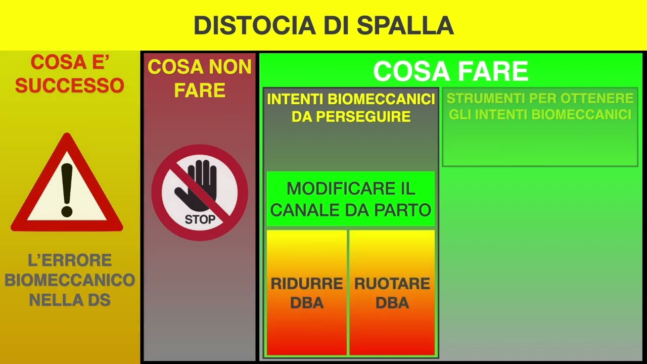 Distocia di spalla. Cosa fare: gli intenti biomeccanici per risolverla