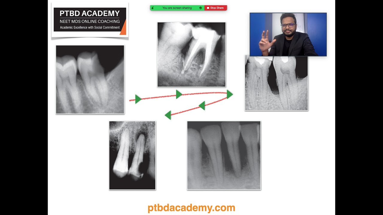 Endodontics | Quick Revision Class - NEET MDS 2021