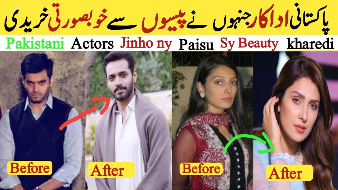 Actors Buy Beauty with Money | Actors transformation | Actors old and new Photos | Wahaj ali | Yumna