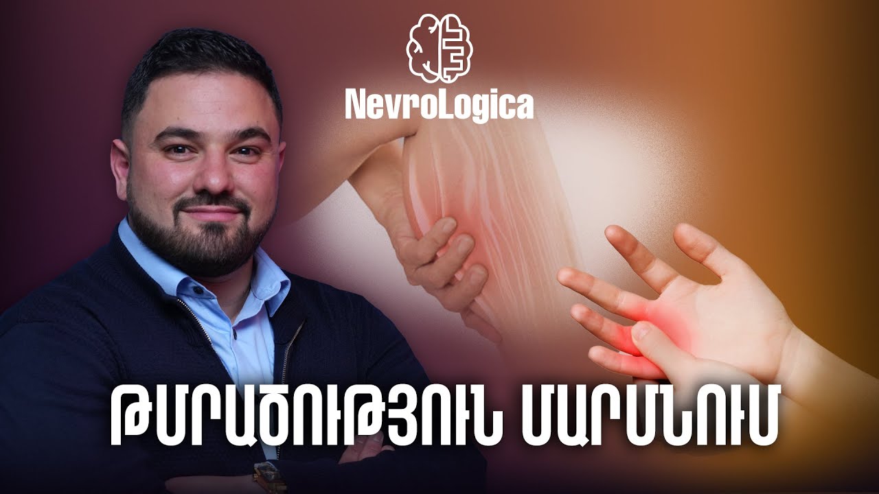 Թմրածություն մարմնում․ տեսակներ և պատճառներ | NevroLogica 09
