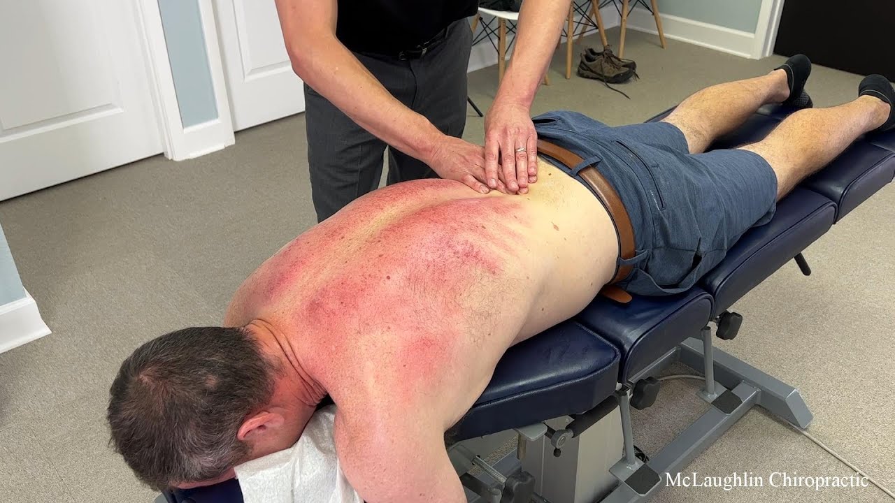 Rugby ACCIDENT Causes BAD Neck Injury! Crunches, GuaSha, & Deep Tissue To Help!
