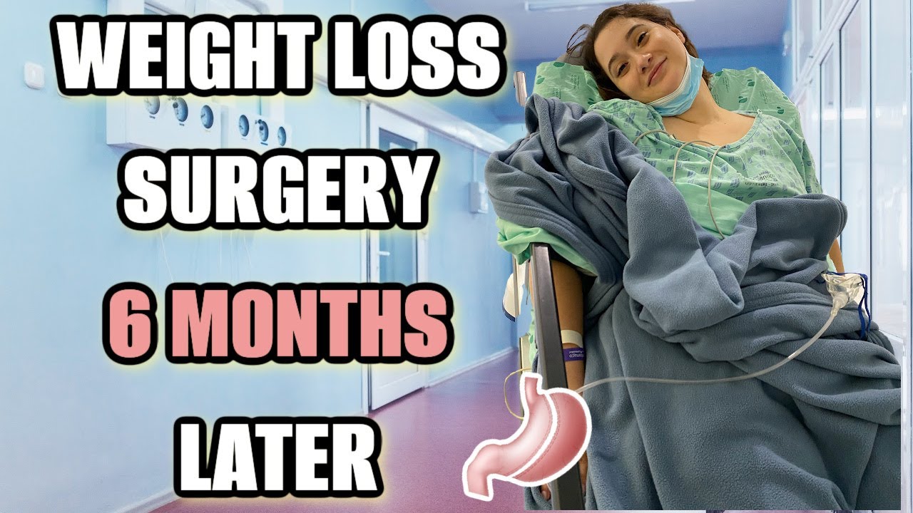 6 MONTH WEIGHT LOSS SURGERY UPDATE | loose skin, eating habits