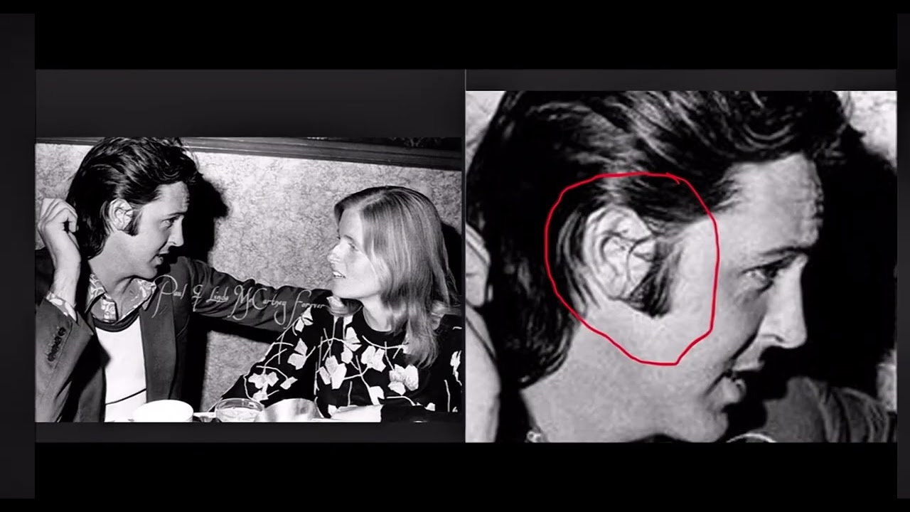 CLEAR Evidence Of Billy Shears&rsquo; Plastic Surgeries
