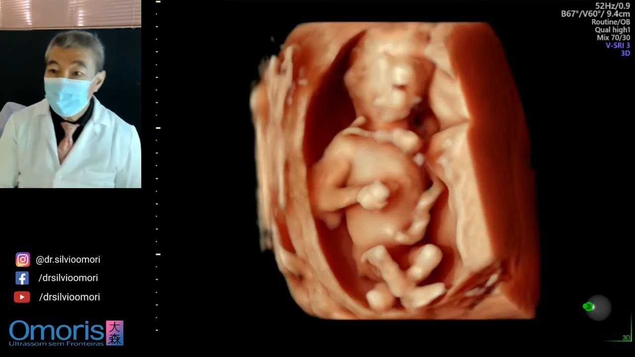Gravidez 15 semanas.