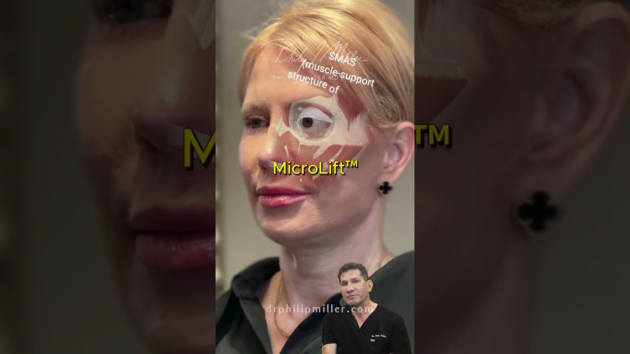 Ear Seeding Can Replace Mini Facelift?