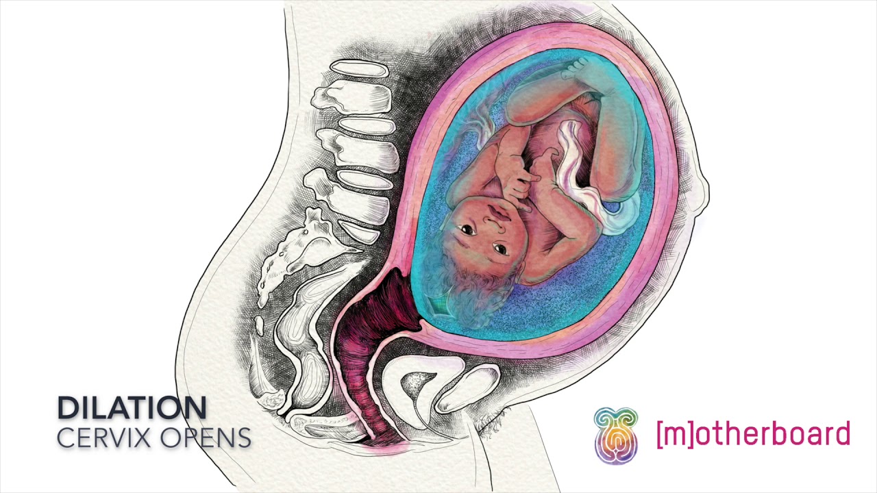 Effacement and Dilation