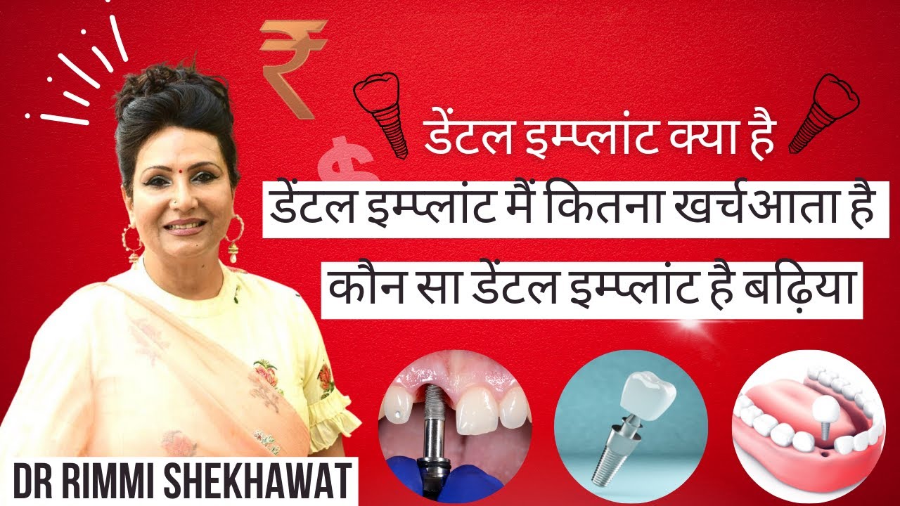 Dental Implant Ka Kharcha Kitna Aata Hai | Dental Implant Procedure | नए दांत लगाने का खर्चा?