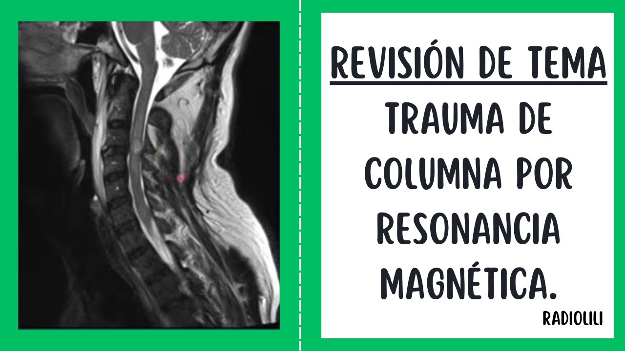 Trauma de Columna por Resonancia Magnética.