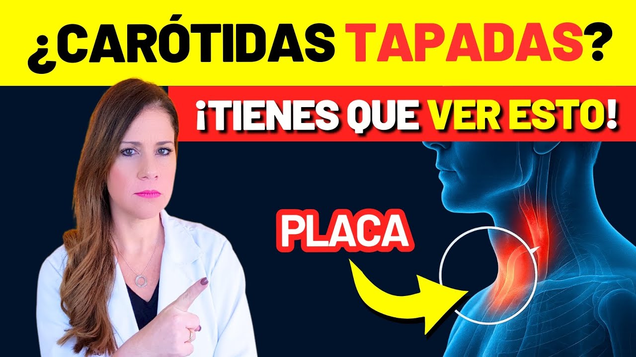 ¿PLACA EN LA CARÓTIDA? 7 PASOS URGENTES para CUIDAR TUS ARTERIAS