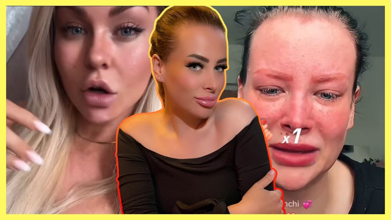 Aline Bachmann bricht wegen Like Us im Livestream zusammen!