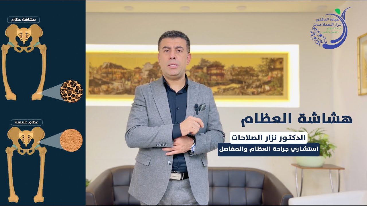 هشاشة العظام / كل ماتريد ان تعرفه