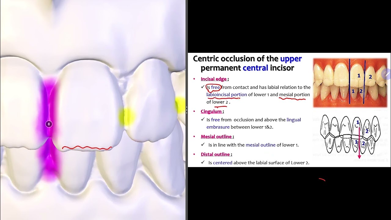 31-  Dental Occlusion P3 Anterior and Premolars | الجزء 3 من الأوكلوجن