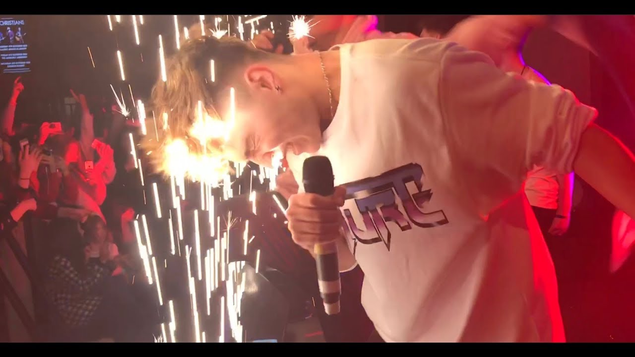 BROOKLYN BURNT HIS FACE ON STAGE!!