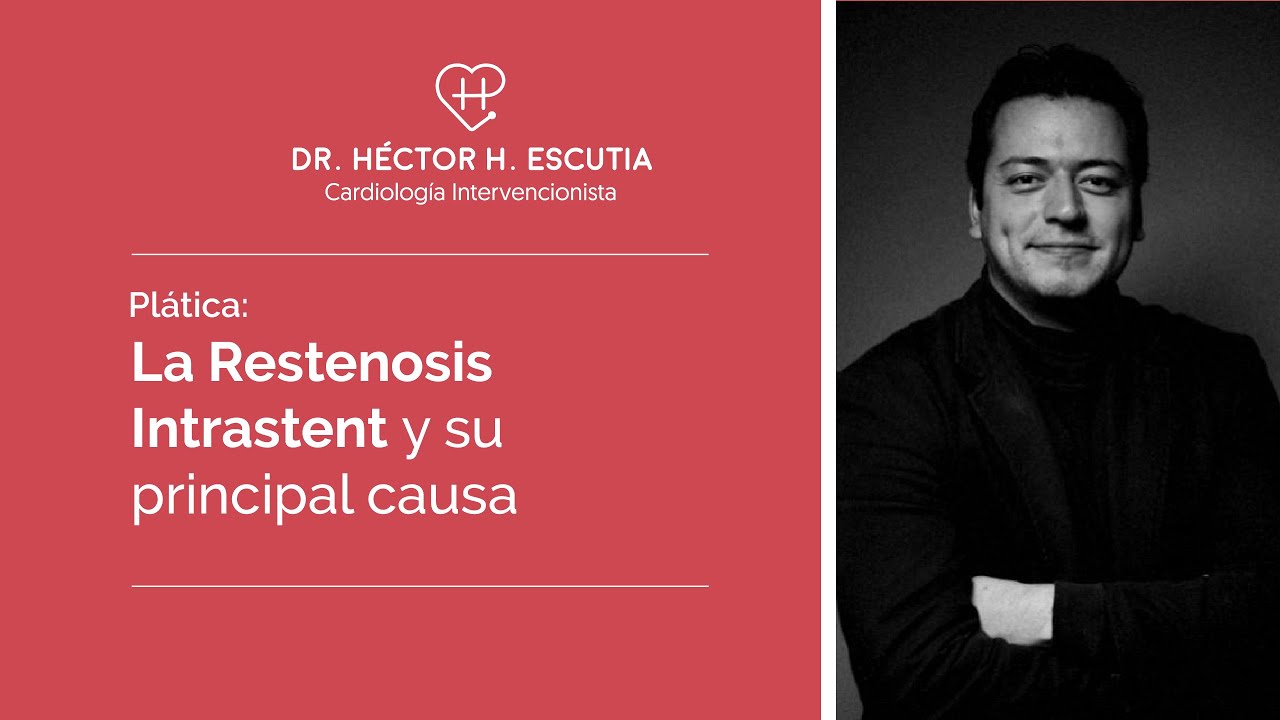 La Restenosis Intrastent y su Principal Causa