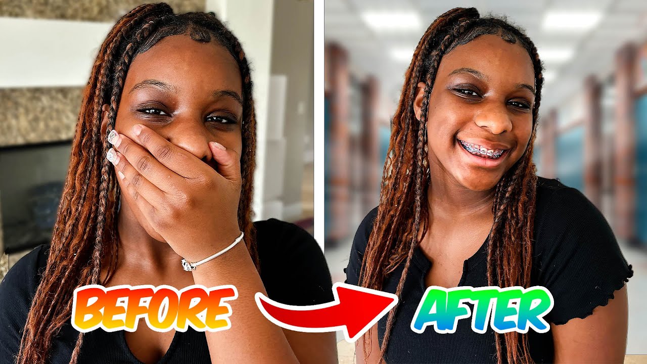 Camari Broke Her Braces At School Oh No!