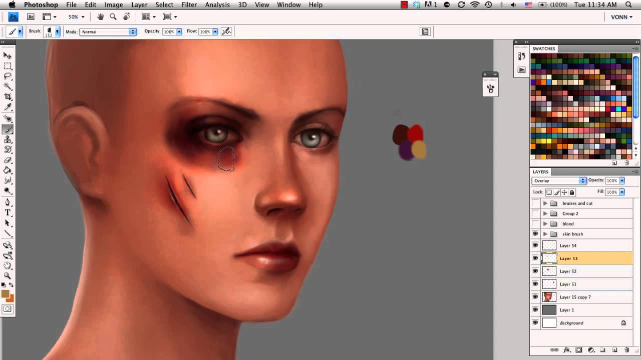 Drawing Blood, Bruises, and Cuts