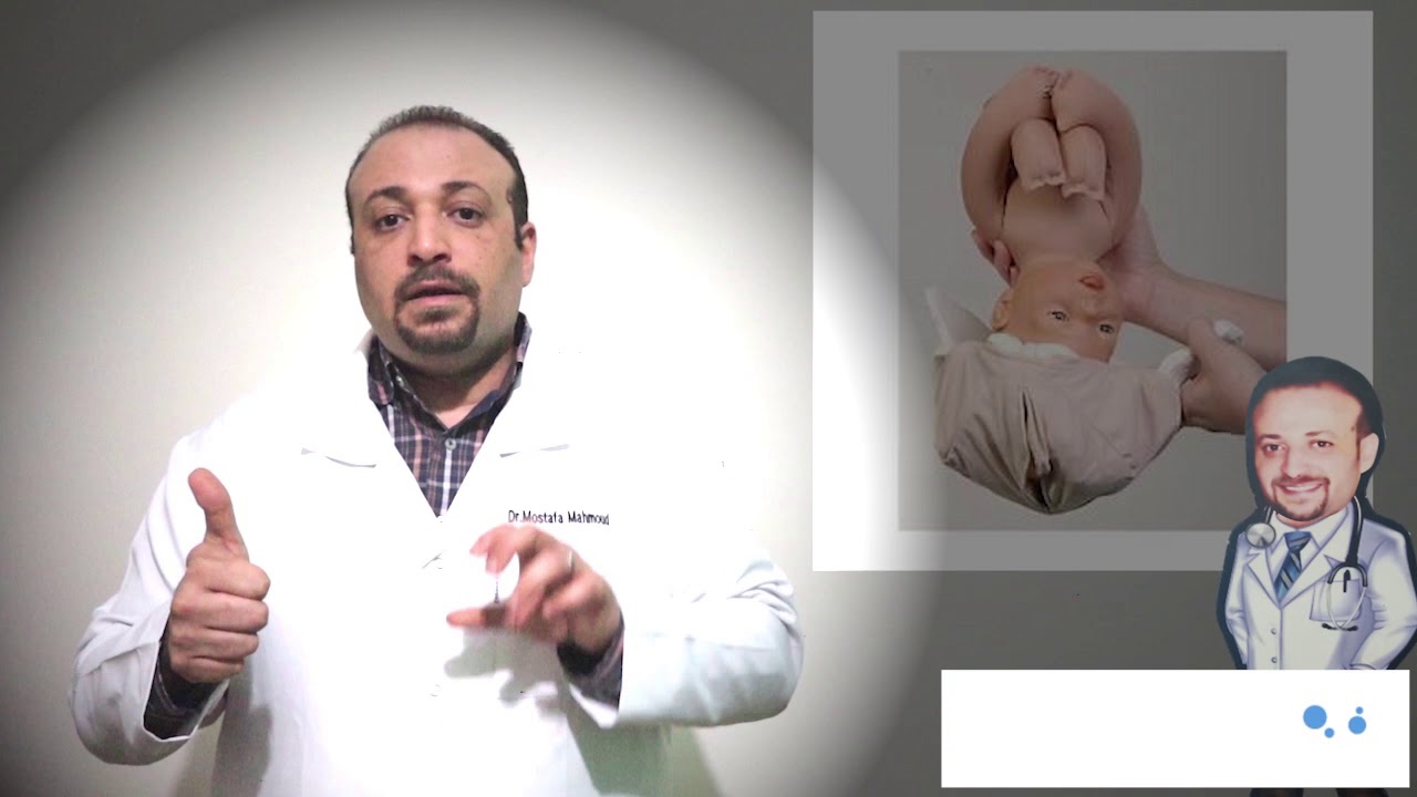 اشكال الحوض عند المراة و تاثيرها علي الولادة الطبيعية