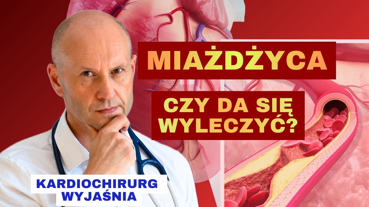 MIAŻDŻYCA – Czy można ją cofnąć?