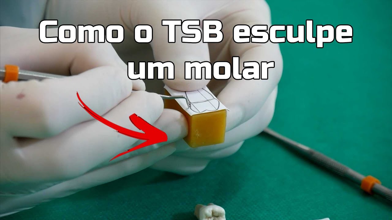 Esculpindo dente em cera parte 3 - Molar