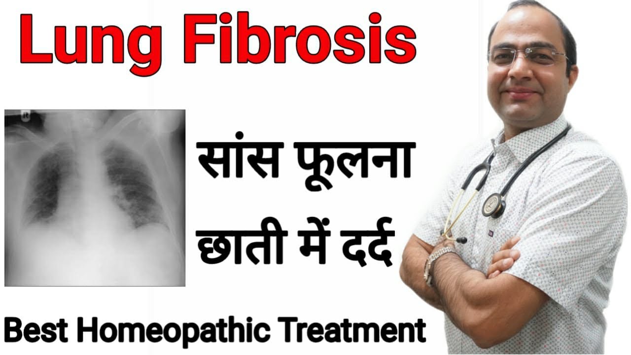 Lungs Fibrosis |Pulmonary Fibrosis |साँस फूलना ।छाती दर्द